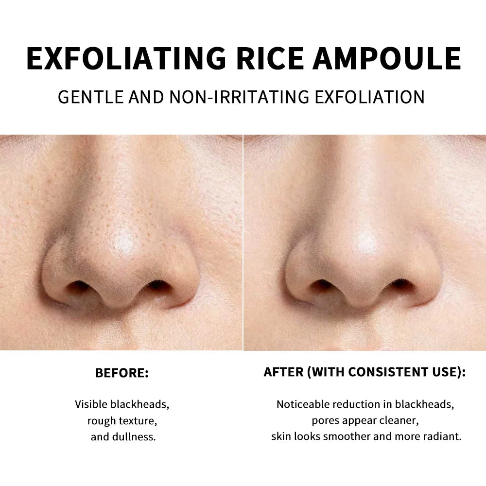 Rice Peeling Ampoule Soft Exfoliating Face and Body Scrub Dead Skin Cells Blackhead Remover for All Skin Types  korean skin care