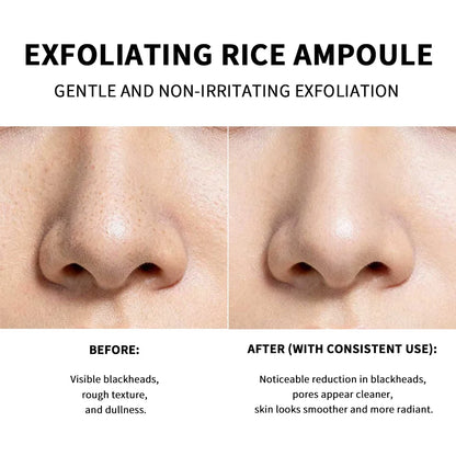 Rice Peeling Ampoule Soft Exfoliating Face and Body Scrub Dead Skin Cells Blackhead Remover for All Skin Types  korean skin care