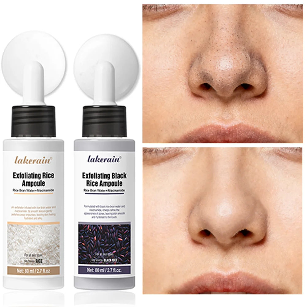 Rice Peeling Ampoule Soft Exfoliating Face and Body Scrub Dead Skin Cells Blackhead Remover for All Skin Types  korean skin care